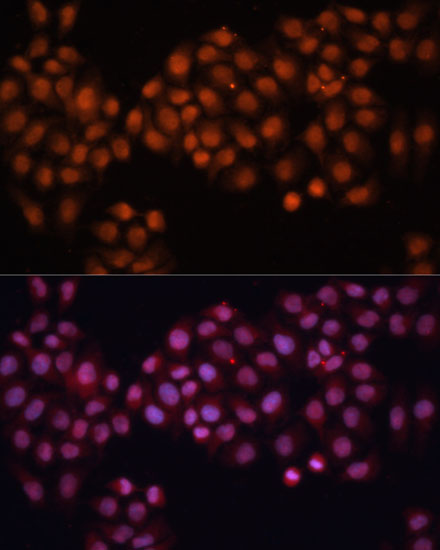 Immunofluorescence analysis of HeLa cells using CDC25A Polyclonal Antibody at dilution of  1:100 (40x lens). Blue: DAPI for nuclear staining.