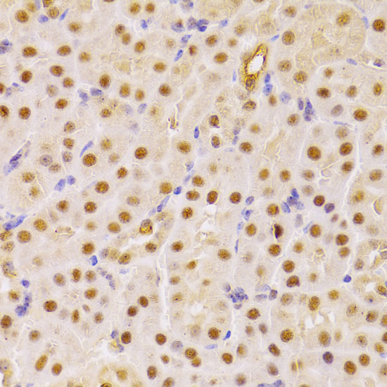 Immunohistochemistry of paraffin-embedded Mouse kidney using CDC25A Polyclonal Antibody at dilution of  1:100 (40x lens).