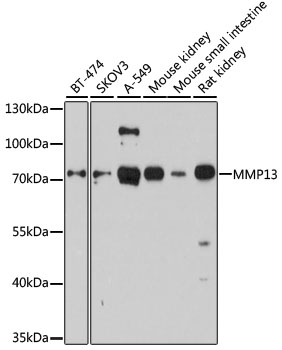 Western blot analysis of extracts of various cell lines using MMP13 Polyclonal Antibody at dilution of 1:1000.