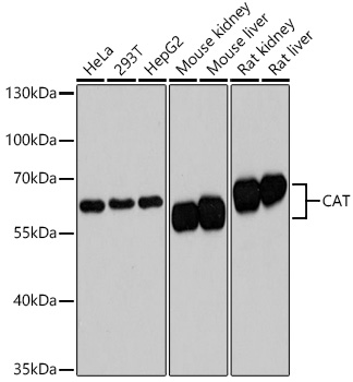 Western blot analysis of extracts of various cell lines using CAT Polyclonal Antibody at dilution of 1:3000.