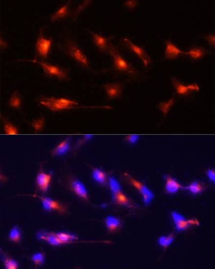 Immunofluorescence analysis of U-251MG cells using Nestin Polyclonal Antibody at dilution of  1:100 (20x lens). Blue: DAPI for nuclear staining.