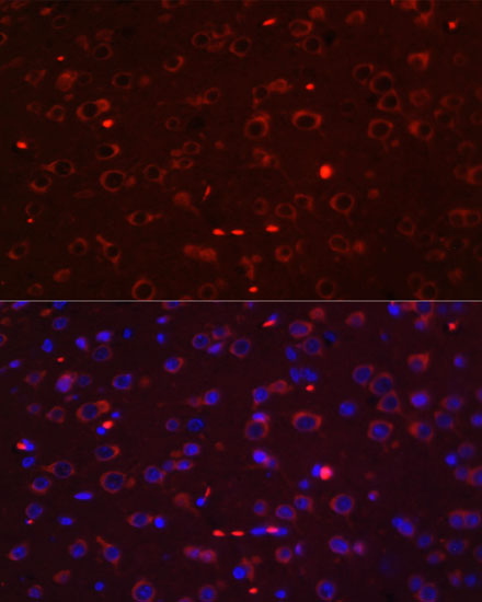 Immunofluorescence analysis of Rat brain using STAT3 Polyclonal Antibody at dilution of  1:100. Blue: DAPI for nuclear staining.