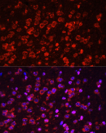 Immunofluorescence analysis of Mouse brain using STAT3 Polyclonal Antibody at dilution of  1:100. Blue: DAPI for nuclear staining.