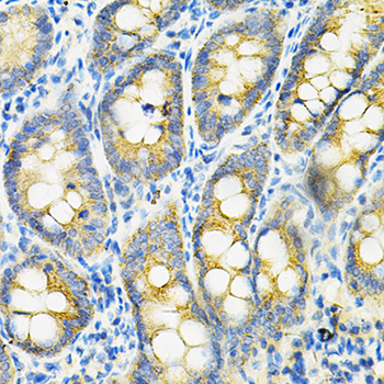 Immunohistochemistry of paraffin-embedded Rat intestine using HGF Polyclonal Antibody at dilution of  1:100 (40x lens).