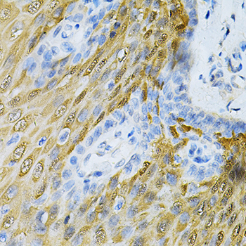 Immunohistochemistry of paraffin-embedded Human esophagus using HGF Polyclonal Antibody at dilution of  1:100 (40x lens).