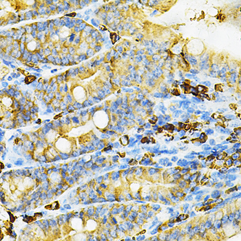 Immunohistochemistry of paraffin-embedded Mouse intestine using HGF Polyclonal Antibody at dilution of  1:100 (40x lens).