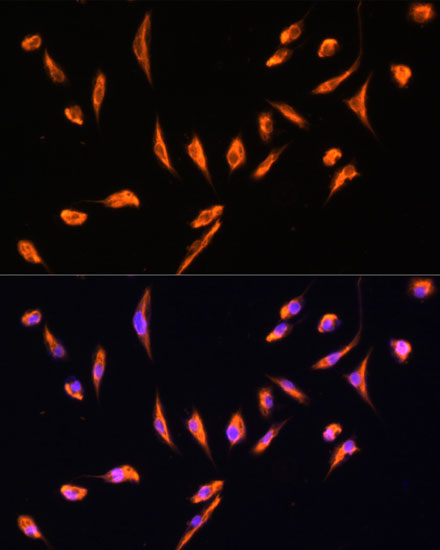 Immunofluorescence analysis of L929 cells using Vimentin Polyclonal Antibody at dilution of  1:100. Blue: DAPI for nuclear staining.