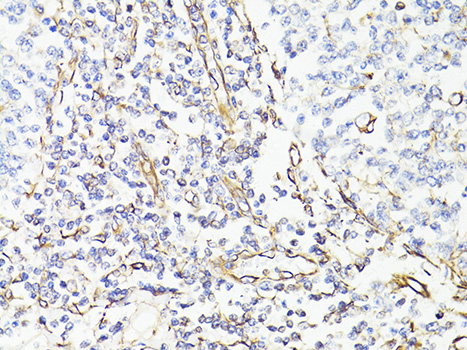 Immunohistochemistry of paraffin-embedded Human tonsil using Vimentin Polyclonal Antibody at dilution of  1:150 (40x lens).