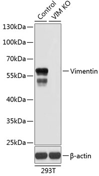 Western blot analysis of extracts from normal (control) and Vimentin knockout (KO) 293T cells using Vimentin Polyclonal Antibody at dilution of 1:1000.