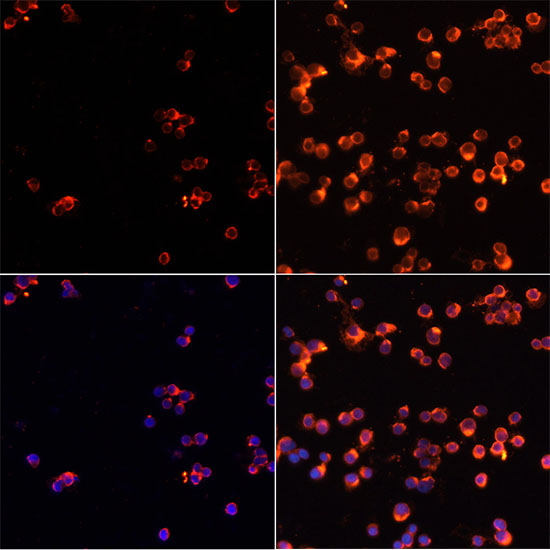 Immunofluorescence analysis of Jurkat cells using Caspase-3 Polyclonal Antibody at dilution of  1:100. Jurkat cells treated by Etoposide 25uM etoposide for 5 hours (left). Blue: DAPI for nuclear staining.