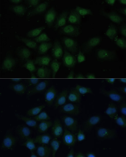 Immunofluorescence analysis of HeLa cells using CREB1 Polyclonal Antibody at dilution of  1:100. Blue: DAPI for nuclear staining.