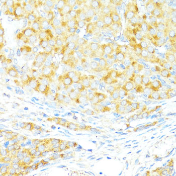 Immunohistochemistry of paraffin-embedded Rat ovary using BAX Polyclonal Antibody at dilution of  1:100 (40x lens).