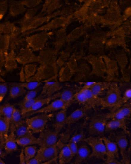 Immunofluorescence analysis of C6 cells using MMP3 Polyclonal Antibody at dilution of  1:100 (40x lens). Blue: DAPI for nuclear staining.