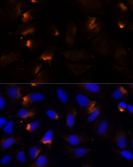 Immunofluorescence analysis of U-2 OS cells using MMP3 Polyclonal Antibody at dilution of  1:100 (40x lens). Blue: DAPI for nuclear staining.