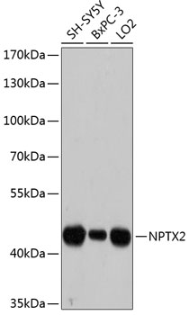 Western blot analysis of extracts of various cell lines using NPTX2 Polyclonal Antibody at dilution of 1:3000.