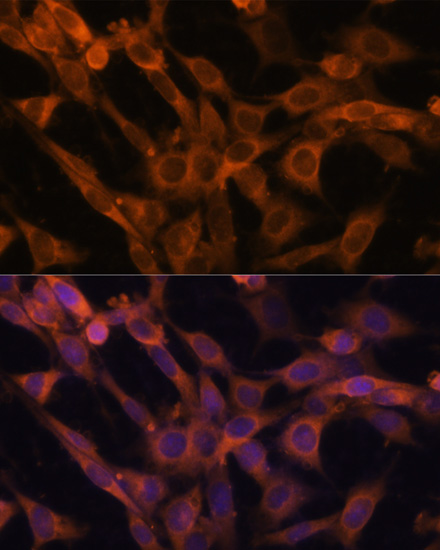 Immunofluorescence analysis of NIH-3T3 cells using RAB21 Polyclonal Antibody at dilution of  1:100. Blue: DAPI for nuclear staining.