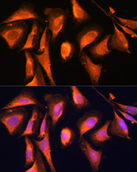 Immunofluorescence analysis of U-2 OS cells using RAB21 Polyclonal Antibody at dilution of  1:100. Blue: DAPI for nuclear staining.