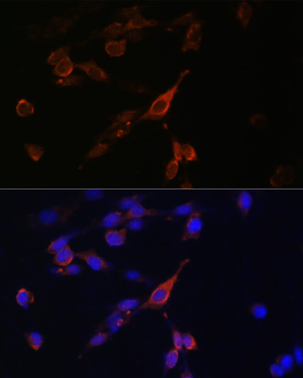 Immunofluorescence analysis of U-2 OS cells using RAB21 Polyclonal Antibody at dilution of  1:100. Blue: DAPI for nuclear staining.