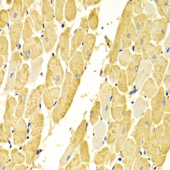 Immunohistochemistry of paraffin-embedded Rat heart using CA3 Polyclonal Antibody at dilution of  1:100 (40x lens).