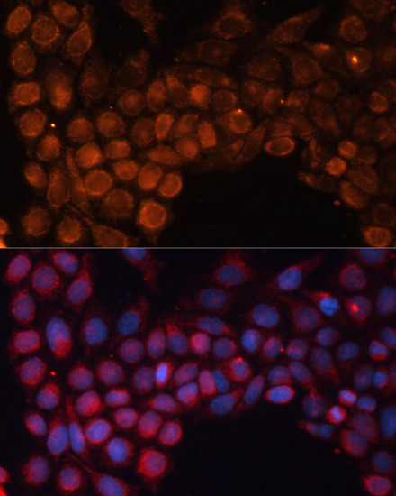 Immunofluorescence analysis of HeLa cells using SLC25A24 Polyclonal Antibody at dilution of  1:100. Blue: DAPI for nuclear staining.