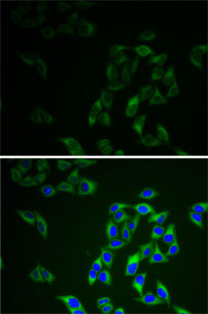Immunofluorescence analysis of HeLa cells using AK1 Polyclonal Antibody