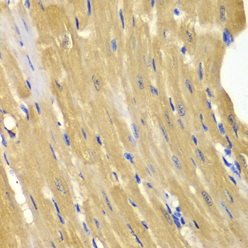 Immunohistochemistry of paraffin-embedded Mouse heart using AK1 Polyclonal Antibody at dilution of  1:100 (40x lens).