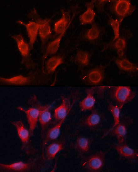 Immunofluorescence analysis of HUVEC cells using VEGF Polyclonal Antibody at dilution of  1:100 (40x lens). Blue: DAPI for nuclear staining.