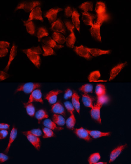 Immunofluorescence analysis of HeLa cells using BST2 Polyclonal Antibody at dilution of  1:100. Blue: DAPI for nuclear staining.