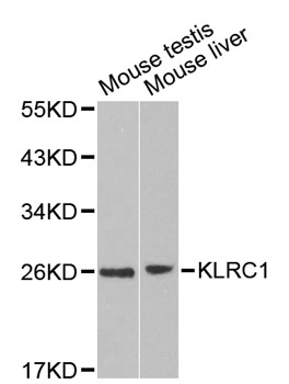 Western blot analysis of extracts of various cell lines using KLRC1 Polyclonal Antibody at dilution of 1:1000.