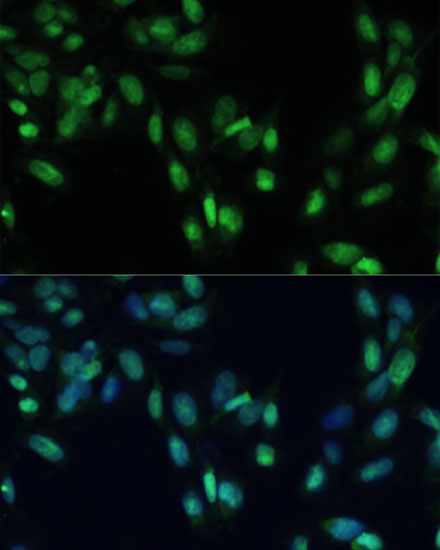 Immunofluorescence analysis of U2OS cells using SMAD7 Polyclonal Antibody at dilution of  1:100. Blue: DAPI for nuclear staining.