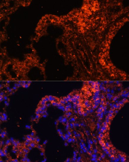 Immunofluorescence analysis of Mouse lung cells using SPTA1 Polyclonal Antibody at dilution of  1:100. Blue: DAPI for nuclear staining.