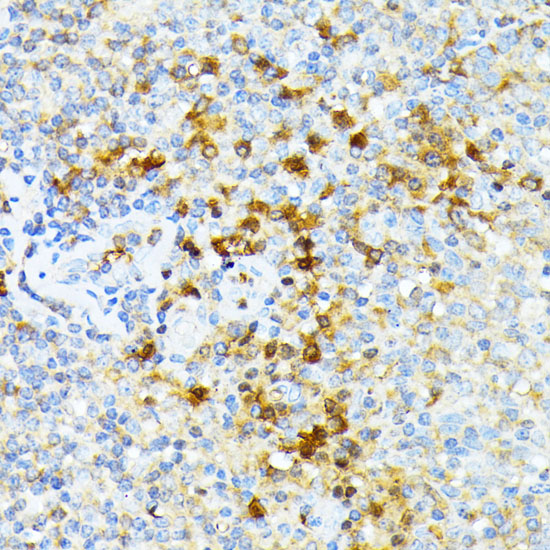 Immunohistochemistry of paraffin-embedded Human tonsil using SPTA1 Polyclonal Antibody at dilution of  1:100 (40x lens).