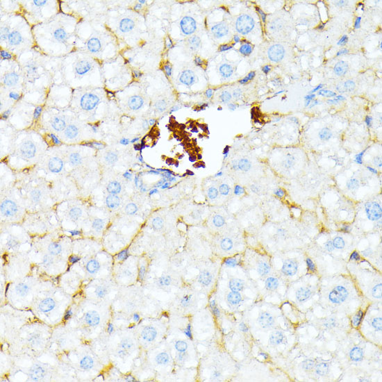 Immunohistochemistry of paraffin-embedded Mouse liver using SPTA1 Polyclonal Antibody at dilution of  1:100 (40x lens).