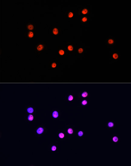 Immunofluorescence analysis of HT-29 cells using UBA1 Polyclonal Antibody at dilution of  1:100. Blue: DAPI for nuclear staining.