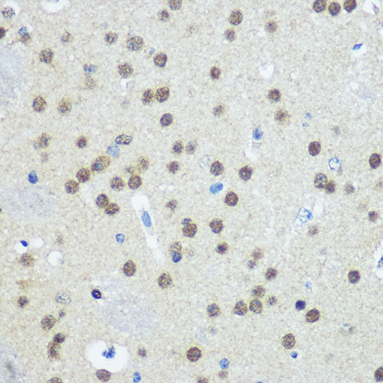 Immunohistochemistry of paraffin-embedded Mouse brain using UBA1 Polyclonal Antibody at dilution of  1:100 (40x lens).