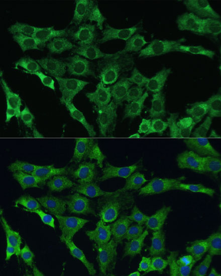 Immunofluorescence analysis of C6 cells using PLSCR3 Polyclonal Antibody at dilution of  1:100 (40x lens). Blue: DAPI for nuclear staining.