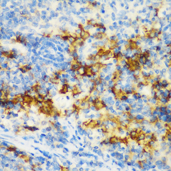 Immunohistochemistry of paraffin-embedded Rat spleen using CD3D Polyclonal Antibody at dilution of  1:200 (40x lens).