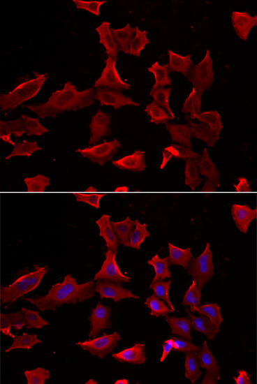 Immunofluorescence analysis of HeLa cells using ADSS Polyclonal Antibody