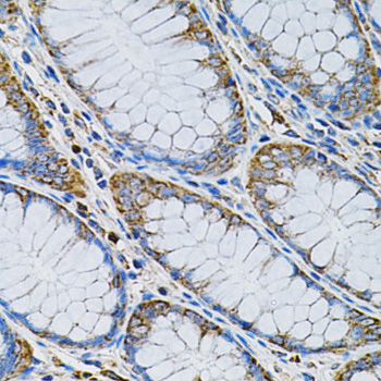 Immunohistochemistry of paraffin-embedded Human colon using ADSS Polyclonal Antibody at dilution of  1:100 (40x lens).