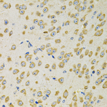 Immunohistochemistry of paraffin-embedded Mouse brain using ADSS Polyclonal Antibody at dilution of  1:100 (40x lens).