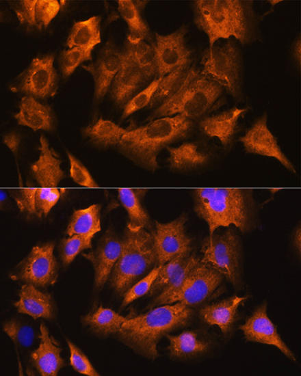 Immunofluorescence analysis of C6 cells using ATP1B1 Polyclonal Antibody at dilution of  1:100. Blue: DAPI for nuclear staining.