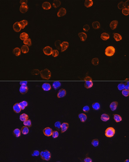 Immunofluorescence analysis of Jurkat cells using CD3E Antigen Polyclonal Antibody at dilution of  1:100. Blue: DAPI for nuclear staining.