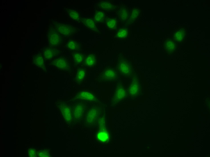 Immunofluorescence analysis of MCF-7 cells using CHAT Polyclonal Antibody