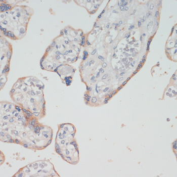Immunohistochemistry of paraffin-embedded Human placenta using CHAT Polyclonal Antibody at dilution of  1:200 (40x lens).