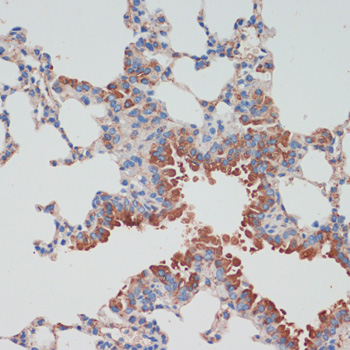 Immunohistochemistry of paraffin-embedded Mouse lung using CHAT Polyclonal Antibody at dilution of  1:200 (40x lens).