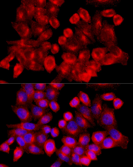 Immunofluorescence analysis of HeLa cells using CLTC Polyclonal Antibody at dilution of  1:100 (40x lens). Blue: DAPI for nuclear staining.