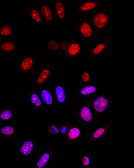 Confocal immunofluorescence analysis of U-2 OS cells using Ataxin 3 Polyclonal Antibody at dilution of  1:100. Blue: DAPI for nuclear staining.