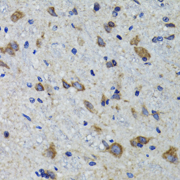 Immunohistochemistry of paraffin-embedded Mouse spinal cord using HEXA Polyclonal Antibody at dilution of  1:100 (40x lens).