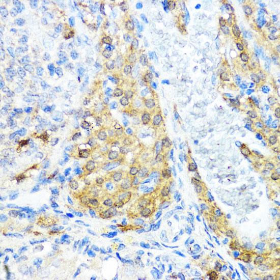 Immunohistochemistry of paraffin-embedded Rat ovary using NOD1 Polyclonal Antibody at dilution of  1:100 (40x lens).