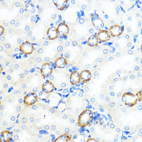 Immunohistochemistry of paraffin-embedded Mouse kidney using NOD1 Polyclonal Antibody at dilution of  1:100 (40x lens).